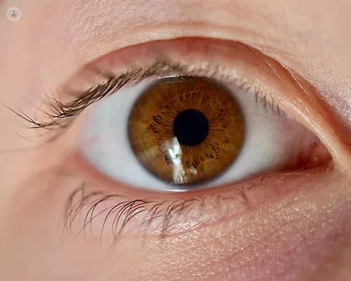 Cirugía láser refractiva