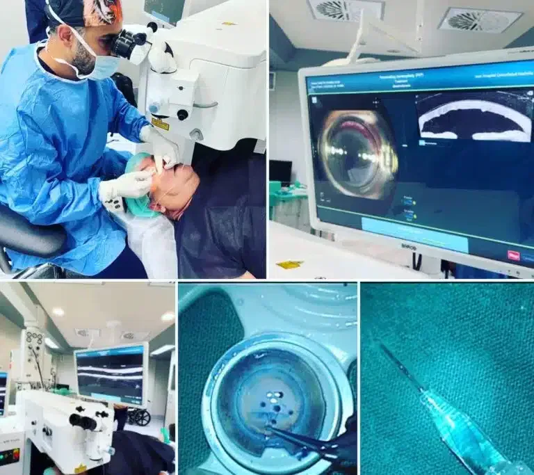 Advantages of DMEK over DSAEK