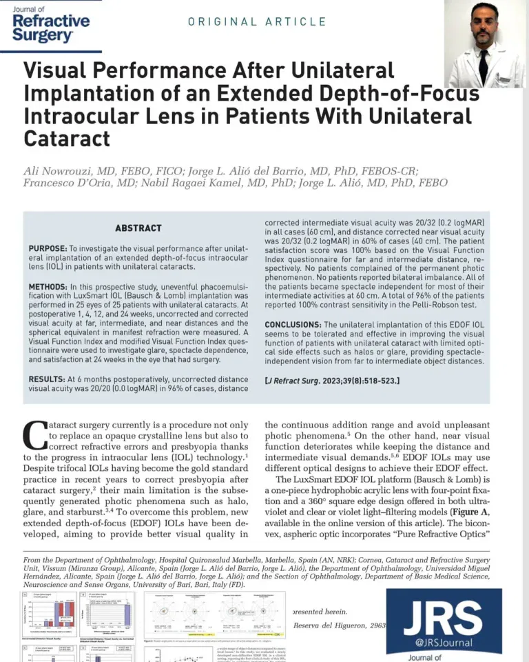 refractive_surgery_ali_nowrouzi