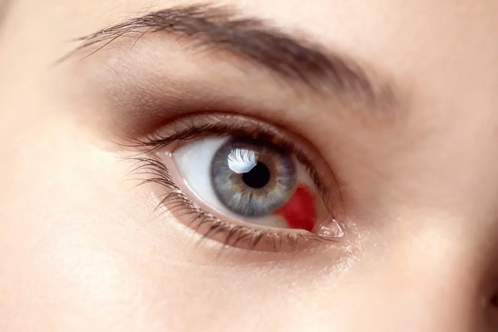 Ojo humano con iris azul y una pequeña mancha roja en la parte blanca, destacando una posible irritación o afección ocular.